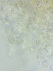 Macrotyphula contorta