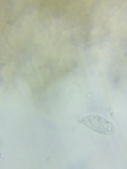 Macrotyphula contorta