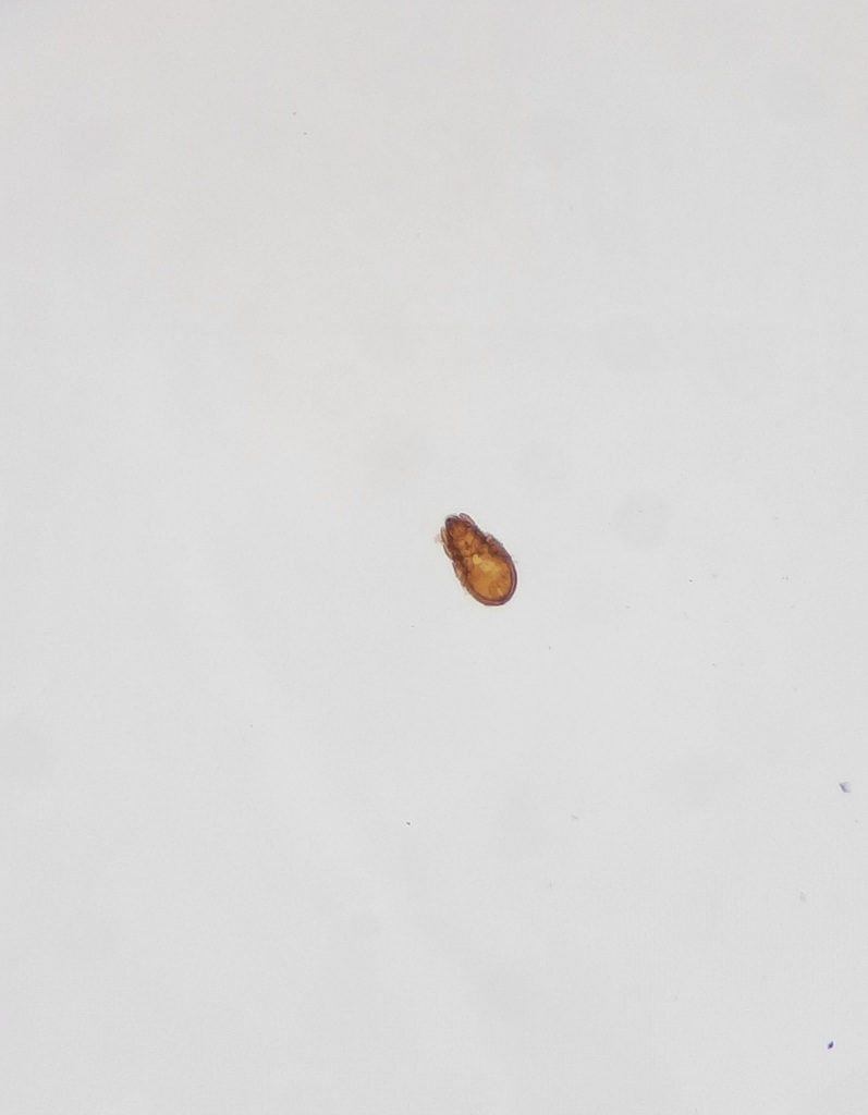 Microzetoidea