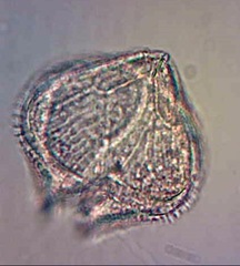 Protoperidinium