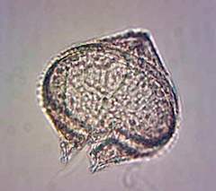 Protoperidinium