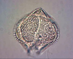 Protoperidinium