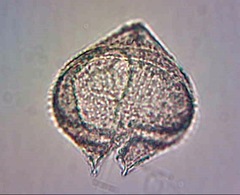 Protoperidinium