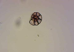 Foraminifera