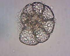 Foraminifera