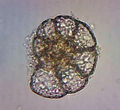 Foraminifera