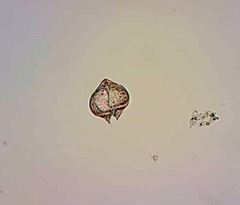 Protoperidinium