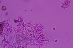 Phanerochaete tuberculata