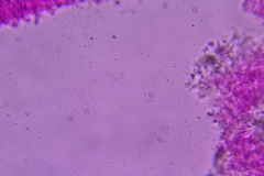 Phanerochaete tuberculata