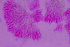 Phanerochaete tuberculata