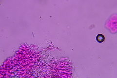 Phanerochaete tuberculata