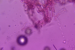 Craterellus calyculus