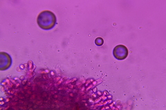 Craterellus calyculus