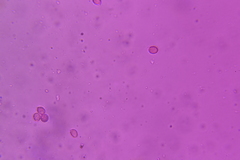 Craterellus calyculus