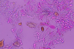 Peniophorella subpraetermissa