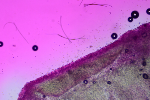 Cystodermella adnatifolia image