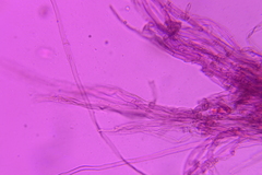 Thelephora anthocephala