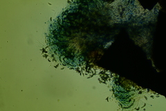 Rosellinia hyalospora