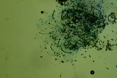 Rosellinia hyalospora