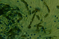 Rosellinia hyalospora