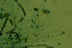 Rosellinia hyalospora