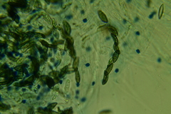 Rosellinia hyalospora