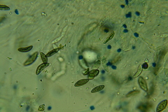 Rosellinia hyalospora