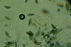 Rosellinia hyalospora
