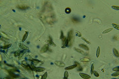 Rosellinia hyalospora