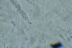 Rosellinia hyalospora