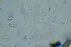 Rosellinia hyalospora
