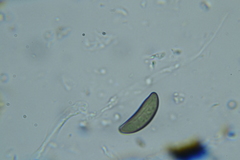 Rosellinia hyalospora