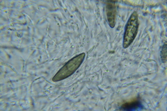 Rosellinia hyalospora