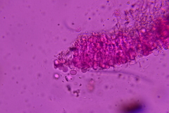 Radulomyces confluens