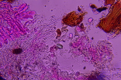 Radulomyces confluens