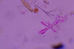 Radulomyces confluens