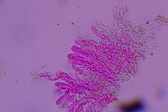 Radulomyces confluens