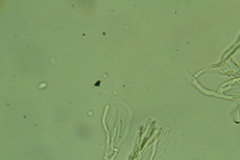 Cylindrobasidium evolvens