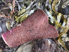 Chondracanthus