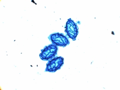 Scutellinia pseudotrechispora image