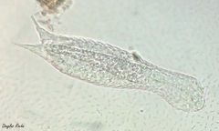 Gastrotricha