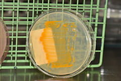 Staphylococcus aureus