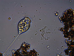 Vorticella