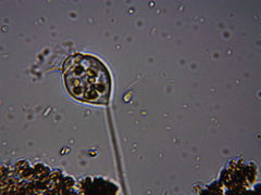 Vorticella
