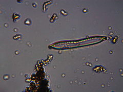 Hantzschia amphioxys