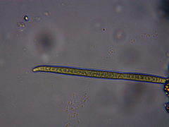Planktothrix