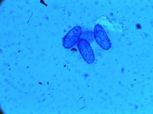 Scutellinia cejpii image