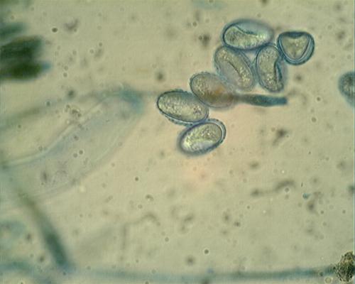 Scutellinia torrentis image