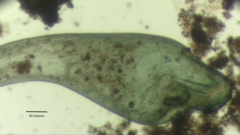 Stentor coeruleus