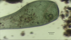 Stentor coeruleus